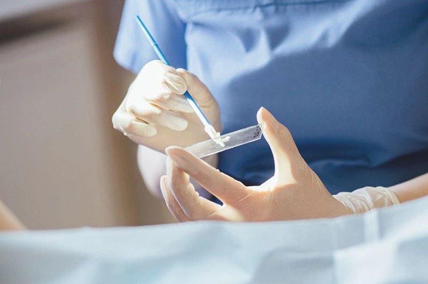 Tại Việt Nam ung thư cổ tử cung xếp thứ 2 trong các loại ung thư phổ biến ở nữ giới (Ảnh minh họa: G.K). Tại Việt Nam ung thư cổ tử cung xếp thứ 2 trong các loại ung thư phổ biến ở nữ giới (Ảnh minh họa: G.K).