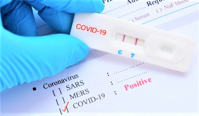 Loạn giá kit test Covid-19, máy đo SpO2: Bộ Y tế ra yêu cầu khẩn