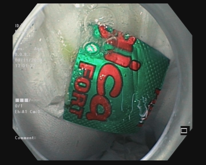 Dị vật là viên thuốc còn nằm trong bao vỉ được Dị vật là viên thuốc còn nằm trong bao vỉ được