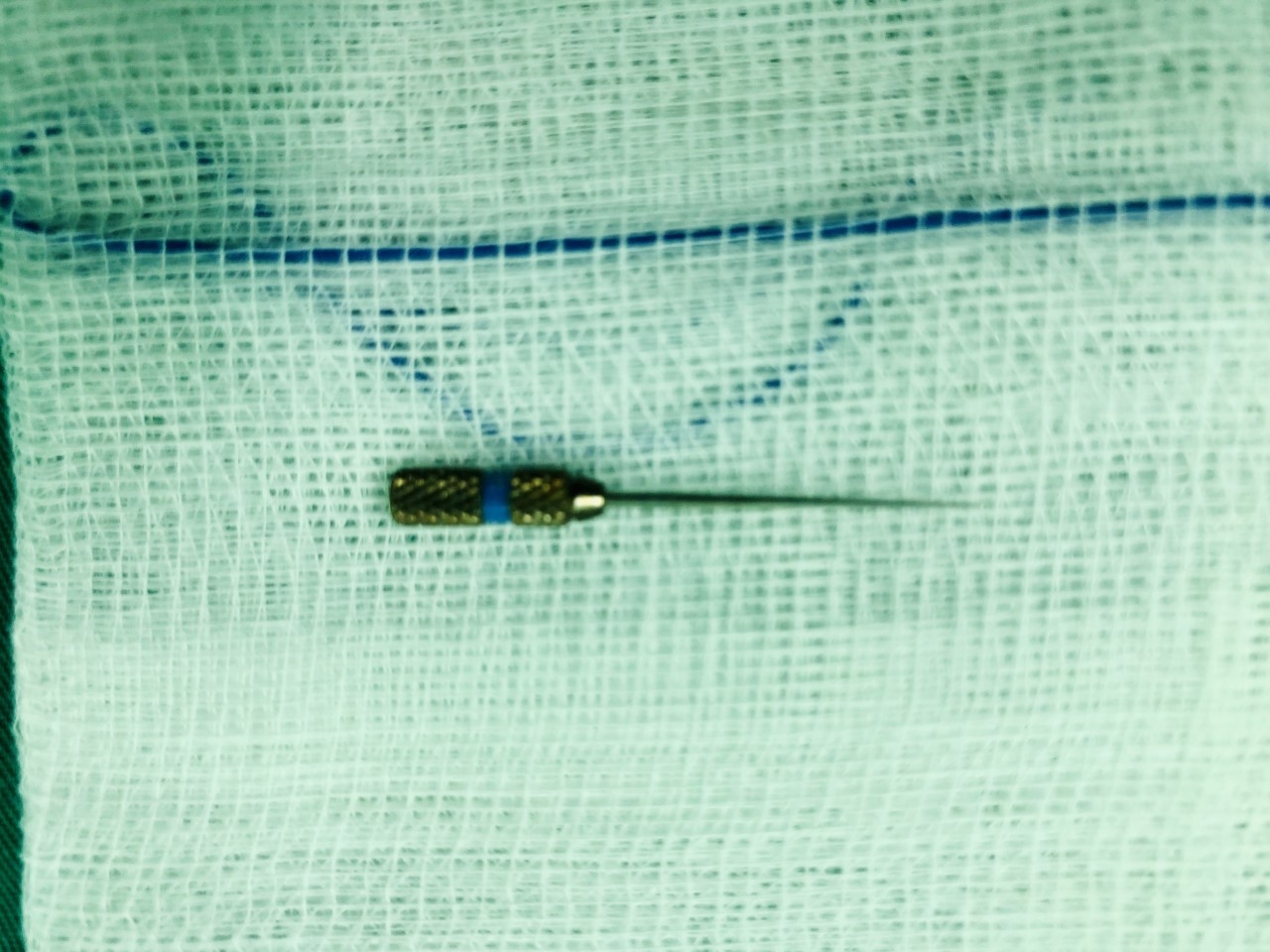 gap thanh cong mui kim nha khoa ra khoi da day benh nhan